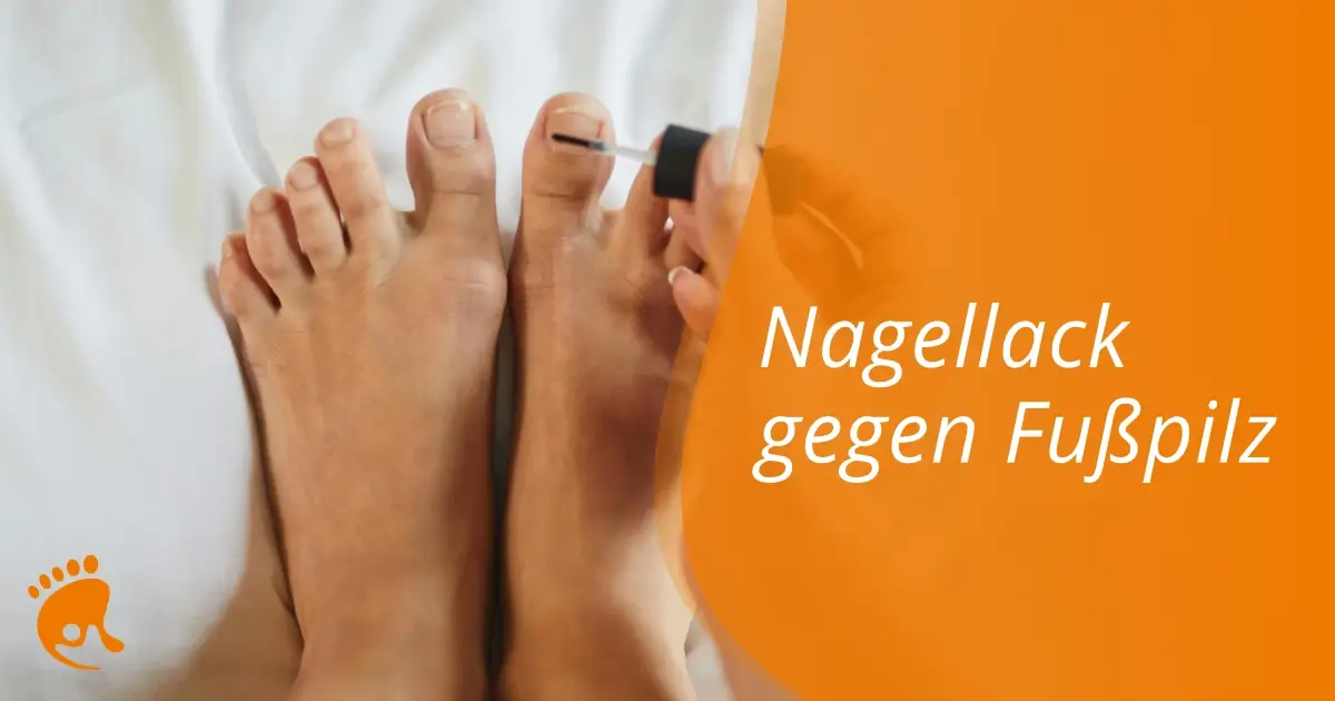 Die Füße einer Person mit Nagellack an den Zehennägeln.