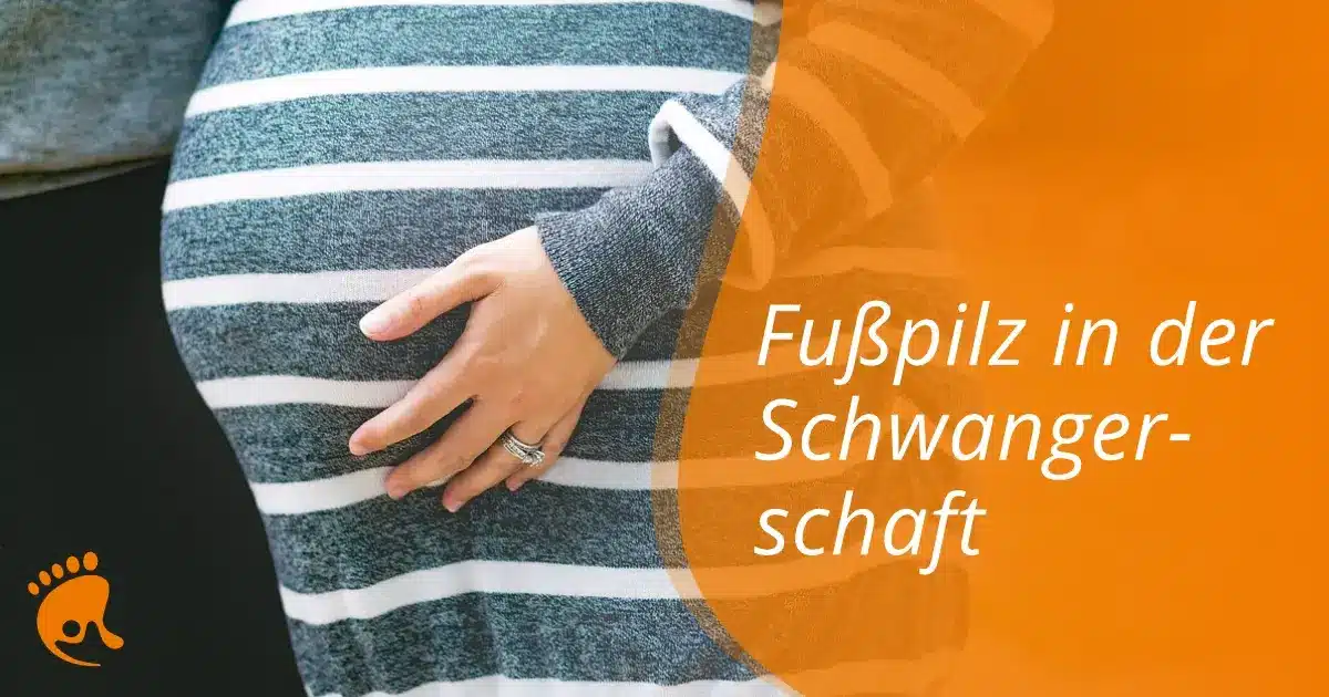 Eine schwangere Frau in einem gestreiften Kleid hält ihren Bauch, während eine andere Person sie umarmt. Der deutsche Text auf der rechten Seite lautet: "Fußpilz in der Schwangerschaft