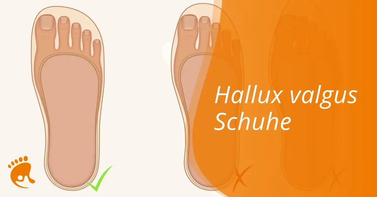 Darstellung von drei Füßen von oben, links mit grünem Häkchen, rechts mit orangefarbenem Kreuz und dem Text 'Hallux valgus Schuhe'