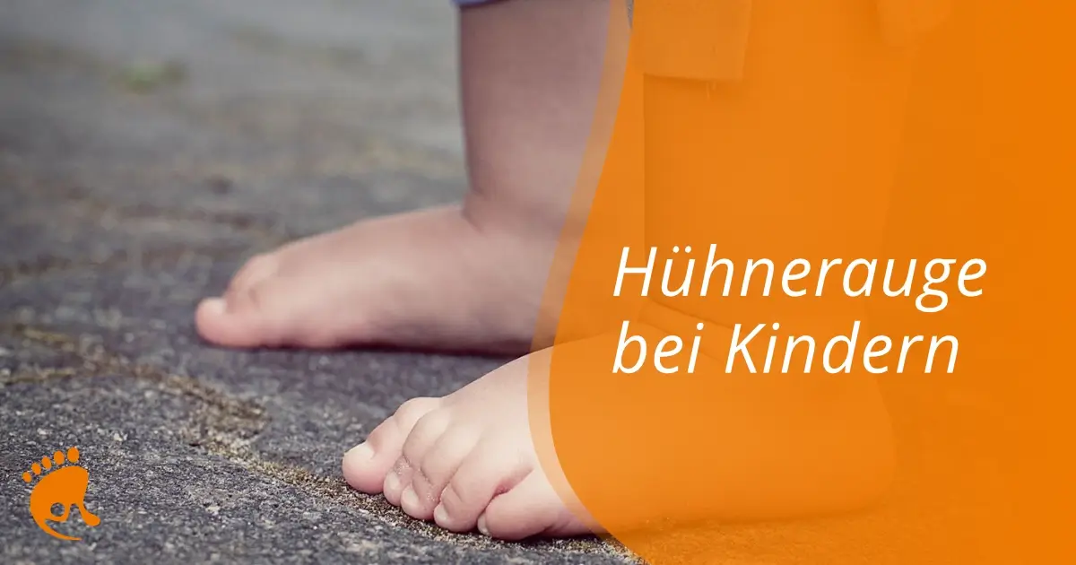 Nahaufnahme eines nackten Kinderfußes auf dem Bürgersteig, mit einem Text in deutscher Sprache: "Hühnerauge bei Kindern"