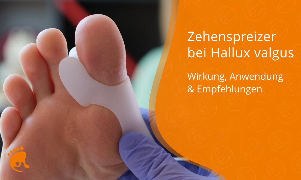 Zehen­sprei­zer bei Hallux valgus: Anwen­dung, Wirkung und Tipps